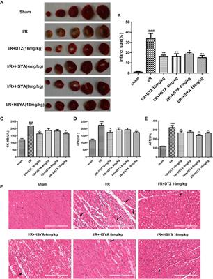 Hydroxysafflor Yellow A Protects Against Myocardial Ischemia/Reperfusion Injury via Suppressing NLRP3 Inflammasome and Activating Autophagy